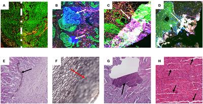 Deep Learning for Whole Slide Image Analysis: An Overview